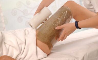 ¿Es posible para las envolturas de los niños para las venas varicosas