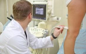 Métodos para el tratamiento de las venas varicosas en las piernas en mujeres
