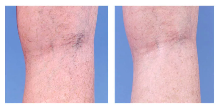 Corrección cosmética